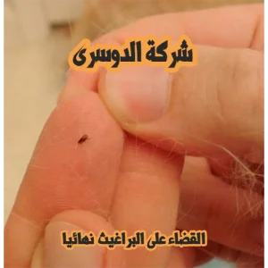 شركة مكافحة الحشرات بجدة 11 شركة مكافحة الحشرات بجدة